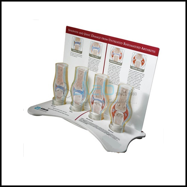 Rheumatoid Arthritis Generic Joint Model