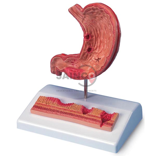 Human Stomach Model