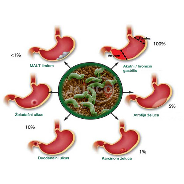 Helicobacter Disease and Infection Model