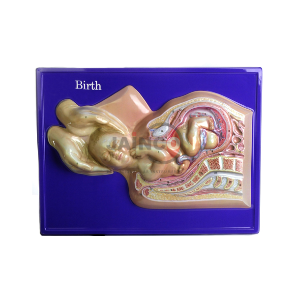 Delivery Birth Set Model