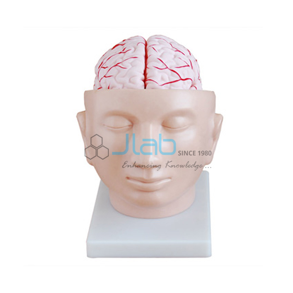 Brain with Arteries on Head