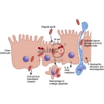 Mechanism of Shigella Infection Model