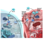 Lung Abscess Complicated by Fungus Ball Model