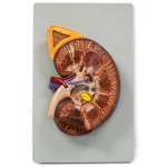 Kidney Model 3x